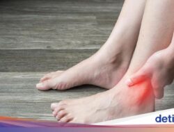 9 Hidangan Pantangan agar Asam Urat Nggak Kumat