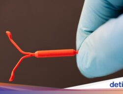 Benarkah Alat KB IUD Hormonal Memicu Kanker Payudara? Ini Kata Ahli