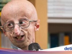 Dialami Sammy Basso, Kenali Penyakit Progeria yang Bikin Pengidapnya Tua Dari Lahir