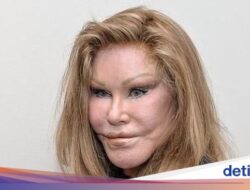 Sosialita Jocelyne Wildenstein Meninggal Di Tidur Siang, Inikah Pemicunya?