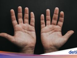 Telapak Tangan Mudah Berkeringat Tanda Punya Penyakit Jantung? Gini Kata Praktisi Medis