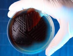 Bakteri Ini Makin Kebal! 45 Persen Antibiotik Hingga Indonesia Tak Bisa Membunuhnya
