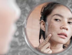 Kulit Susah Banget Glowing? Bisa Bersama Sebab Itu Skin Barrier Rusak, Ini Saran Praktisi Medis