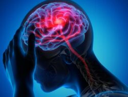 Soal Stroke Di Usia Muda, Ahli Kebugaran Saraf Minta Tak Anggap Sepele Kebiasaan Ini