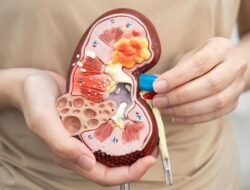 7 Kebiasaan yang Tak Disadari Bisa Merusak Ginjal