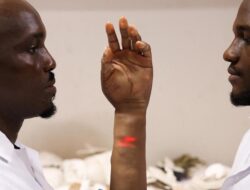 Keren, Lengan Bionik Bersama Nigeria Seperti Kulit Manusia