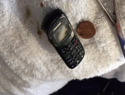 Momen Ahli Kebugaran Keluarkan Smart Phone Bersama Lambung Pasien, Begini Penampakannya