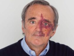 Viral Sosok Dr Mariano Barbacid, Peneliti yang Sukses ‘Lumpuhkan’ Kanker Pankreas