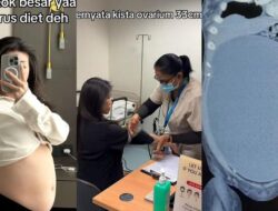 Dialami Wanita Ke Surabaya, Obgyn Beberkan Ciri-ciri Perut Buncit Akibat Kista