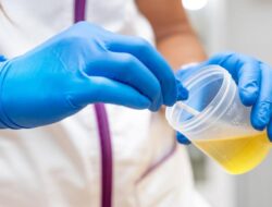Ahli Kebugaran Wanti-wanti Urine Terlalu Jernih Tak Selalu Sehat, Bisa Karena Itu Tanda Gangguan Ginjal